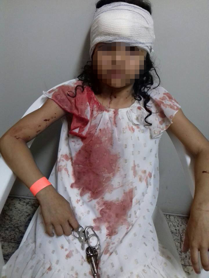 Trave de escola cai sobre criança de seis anos em Vitória